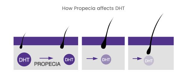 Graphic showing how Finasteride (Propecia) affects DHT and encourages hair growth