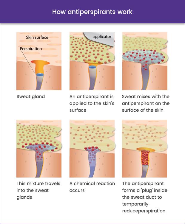 graphic showing how antiperspirants works