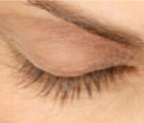 Upper lash result