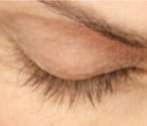 Upper lash result